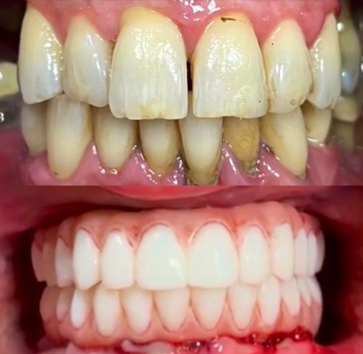 Morgan Hill Dentistry & Implants photo 5