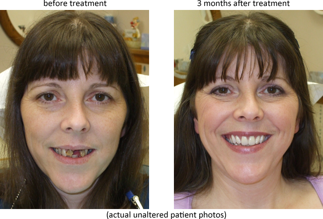 Swiss Denture & Implant Center photo 5