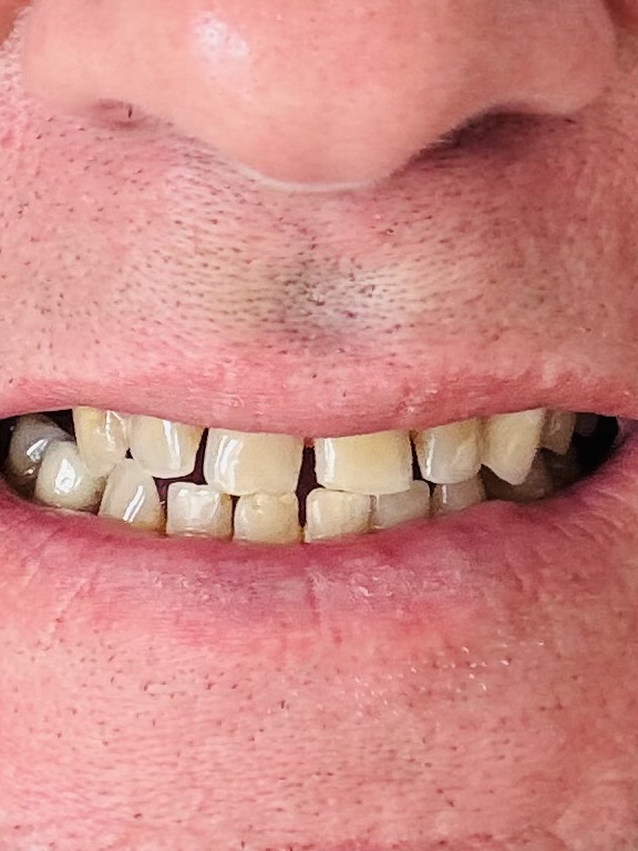 Florida City Dental - General Dentistry & Cosmetic Smile Design! photo 6