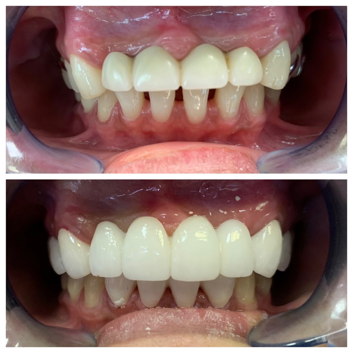Schroeder Cosmetic & Family Dentistry photo 2