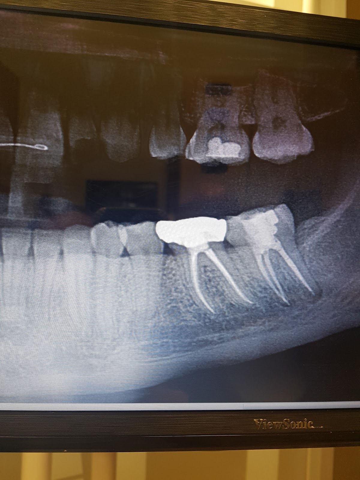 Aspen Dental - Winter Haven photo 2