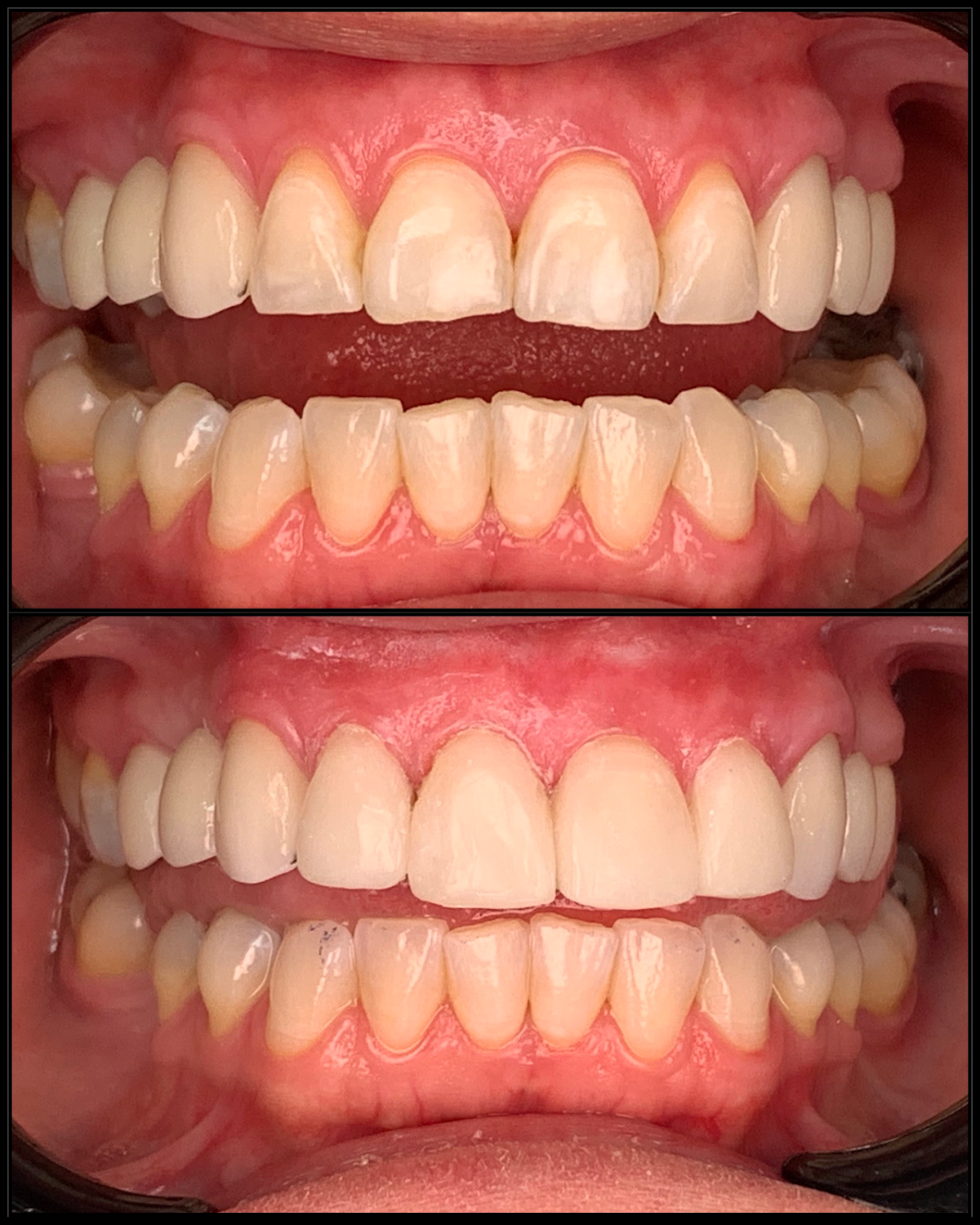 Rapid City Smiles: Implant & Family Dentistry photo 2