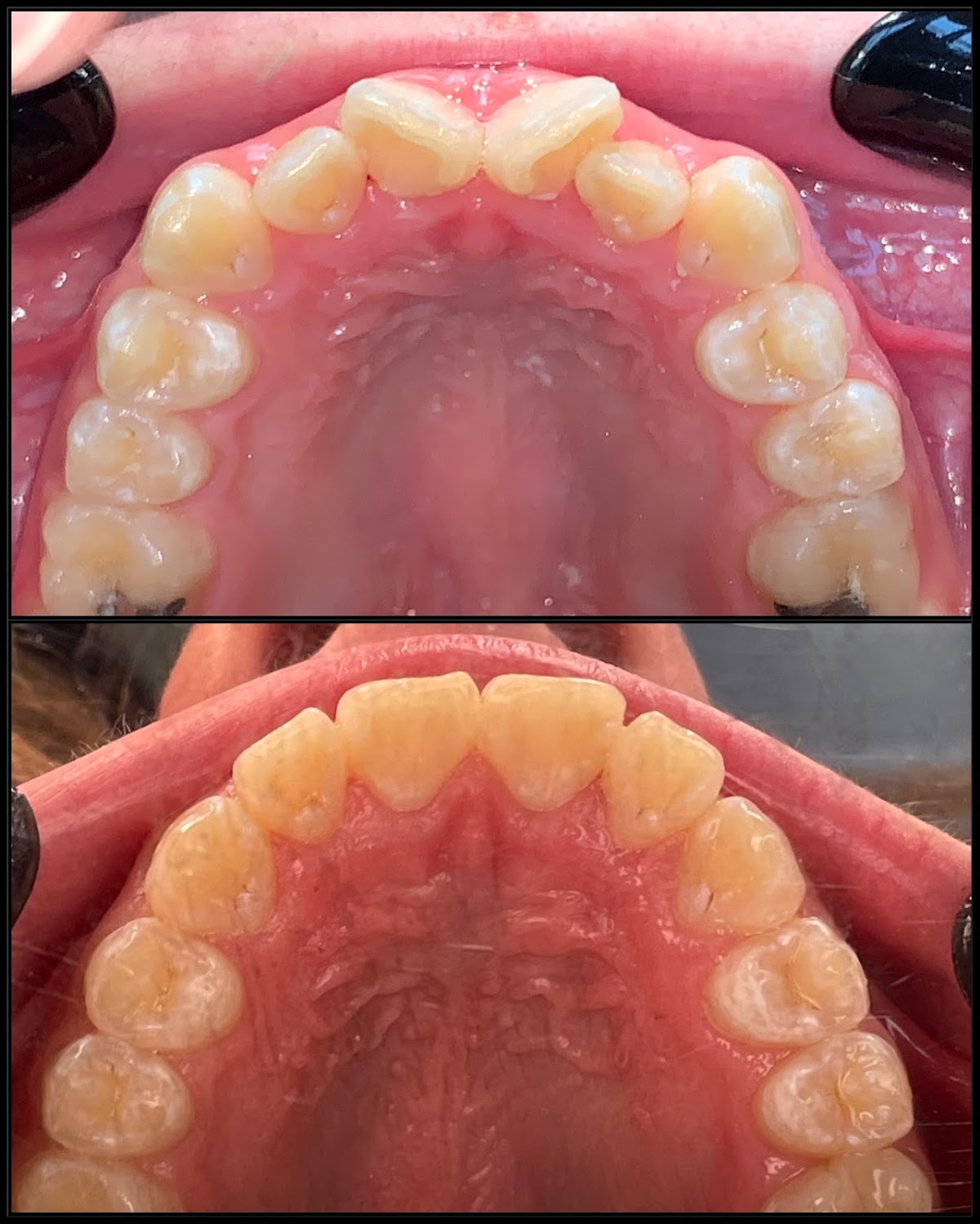 Rapid City Smiles: Implant & Family Dentistry photo 3