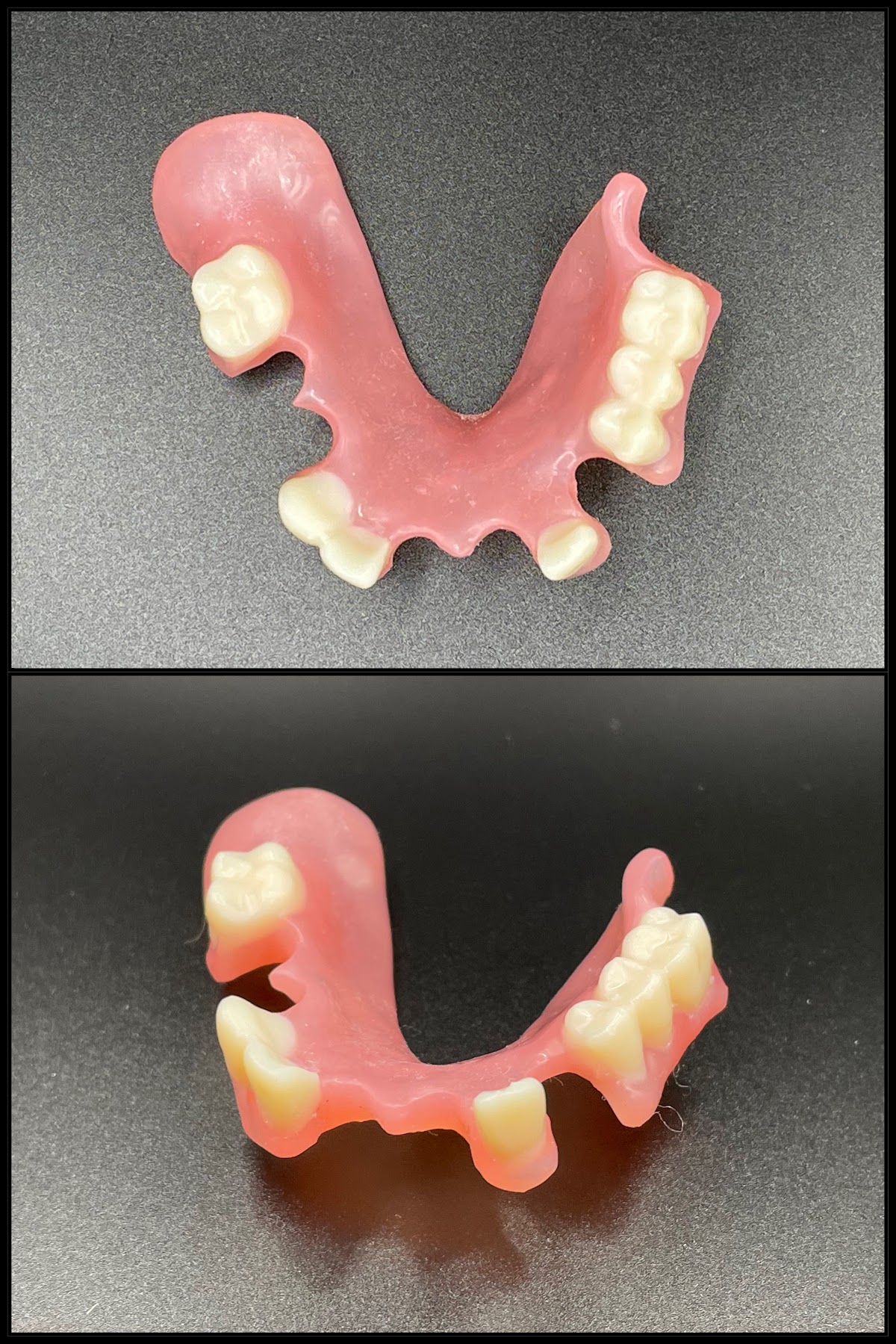 Rapid City Smiles: Implant & Family Dentistry photo 5