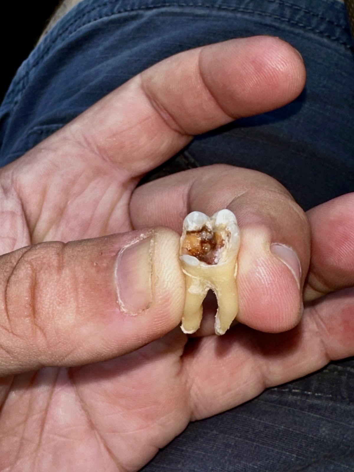 Catawba Valley Dental: Pate Raymond G Dmd,pa photo 6
