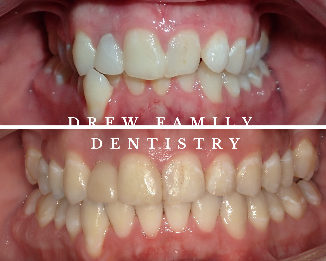 Drew Family Dentistry photo 6
