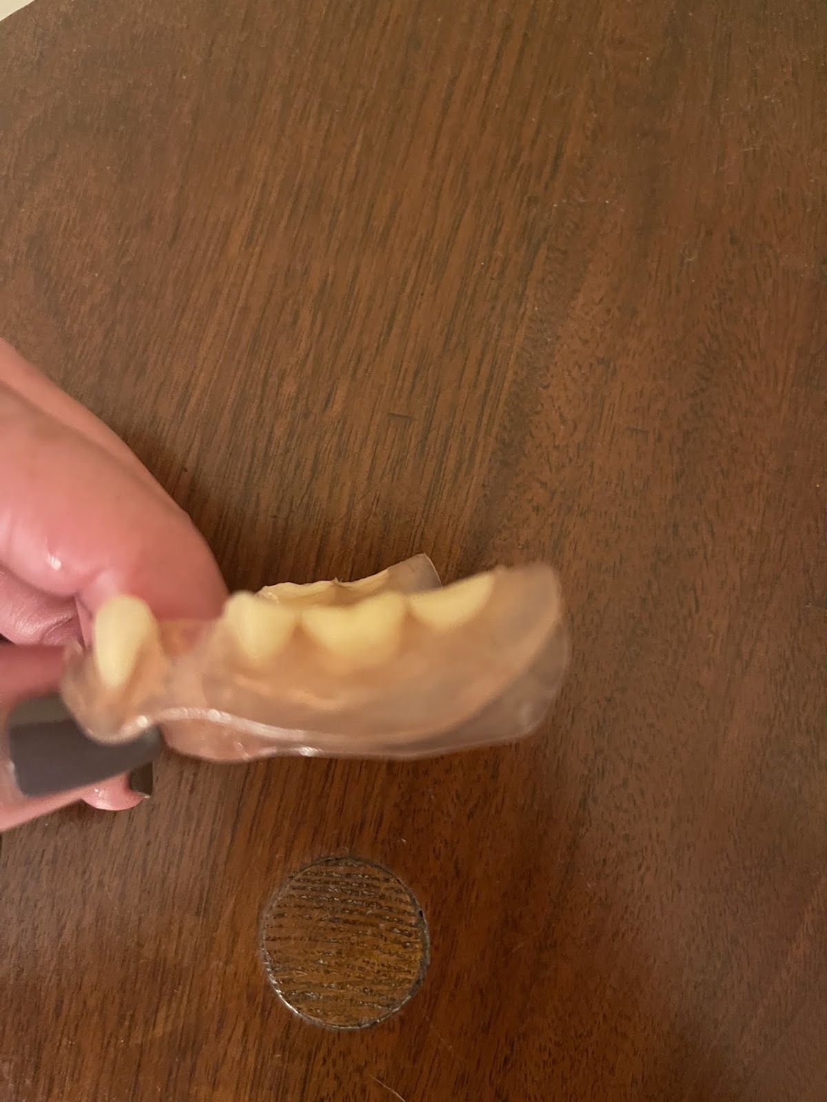 Aspen Dental - Rincon photo 4