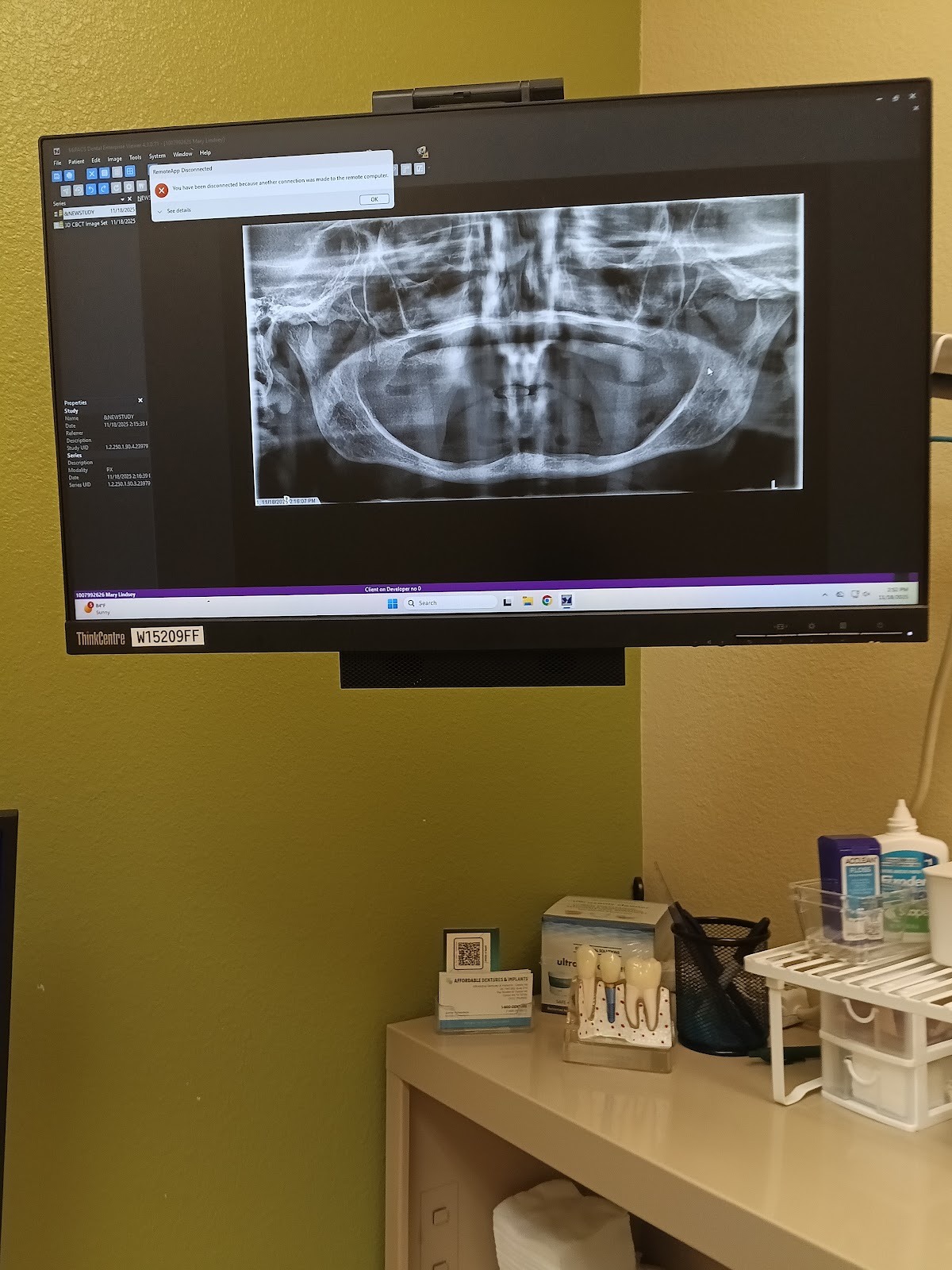 Affordable Dentures & Implants - Cedar Hill photo 6