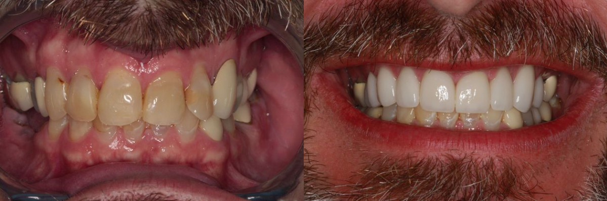 Southern Dental Implant Center photo 1
