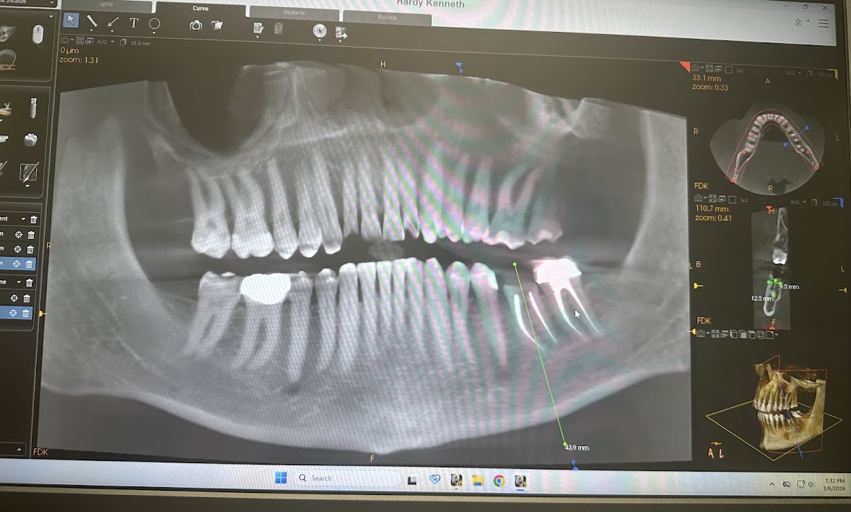 Affordable Dentures & Implants - Spring photo 4