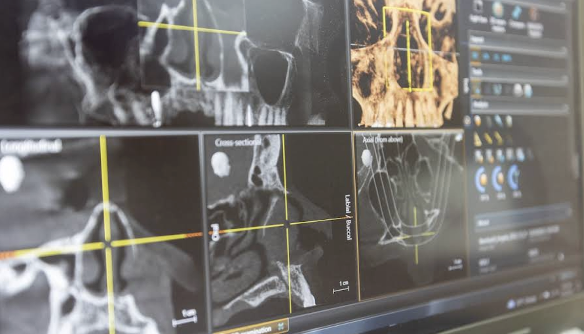 Eastern Washington Implants and Periodontics Yakima photo 4