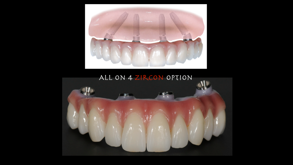 Specialists in Implant Dentistry - Dr Matthew Holtan photo 2