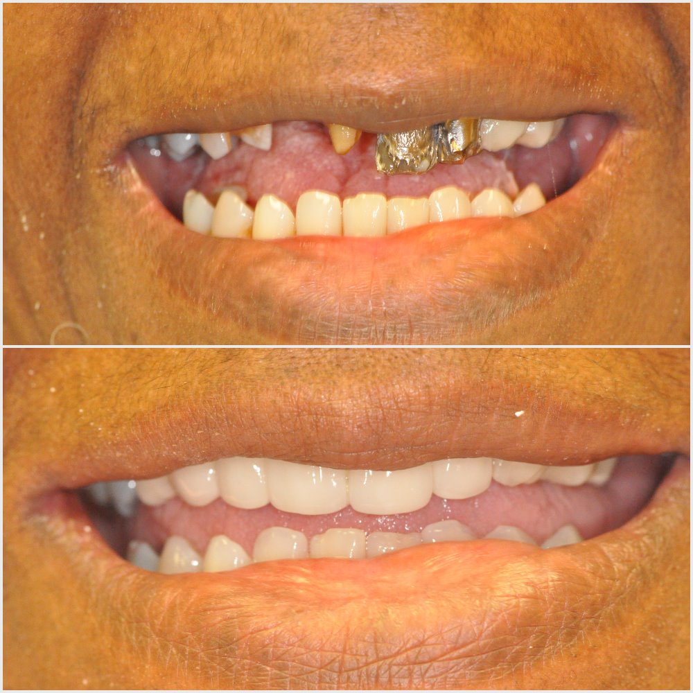 Nashville Cosmetic and Implant Dentistry photo 3