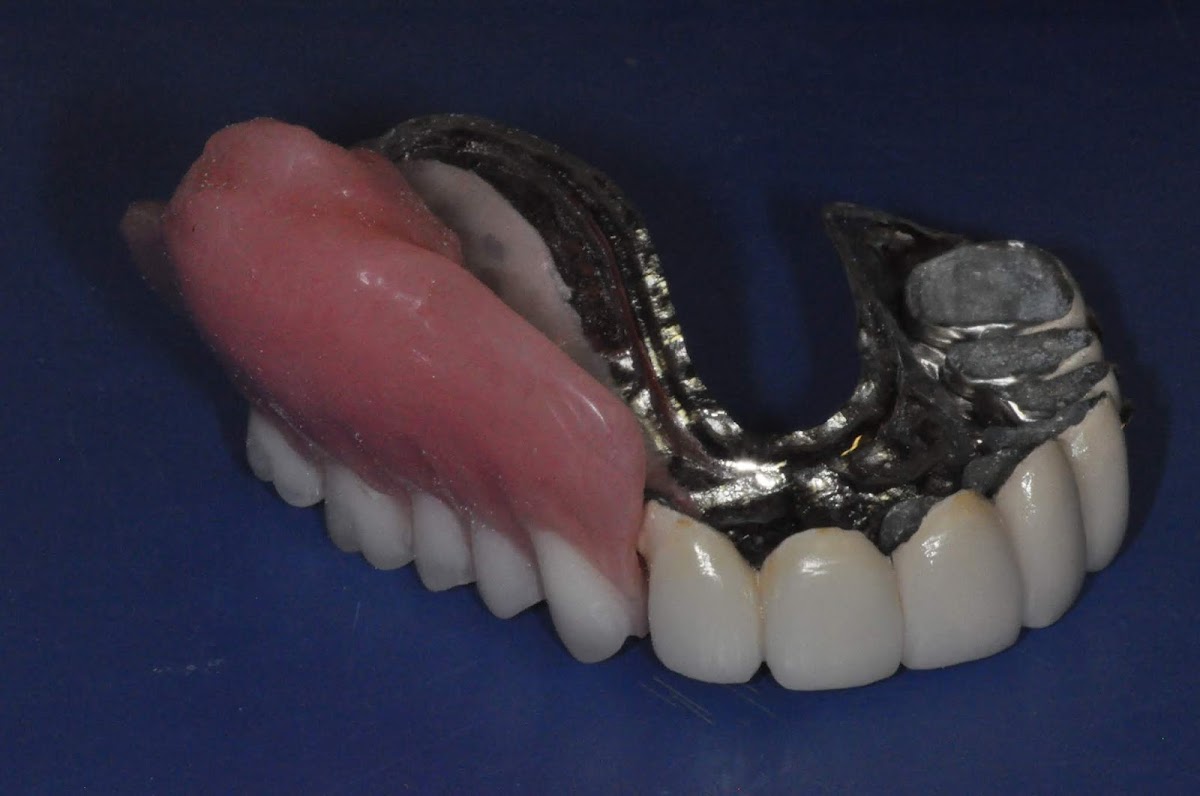 Nashville Cosmetic and Implant Dentistry photo 4