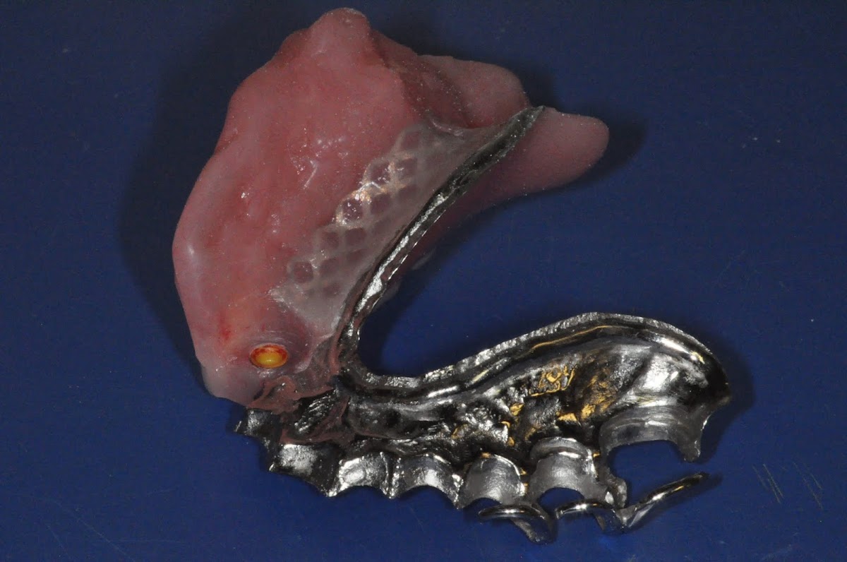 Nashville Cosmetic and Implant Dentistry photo 5