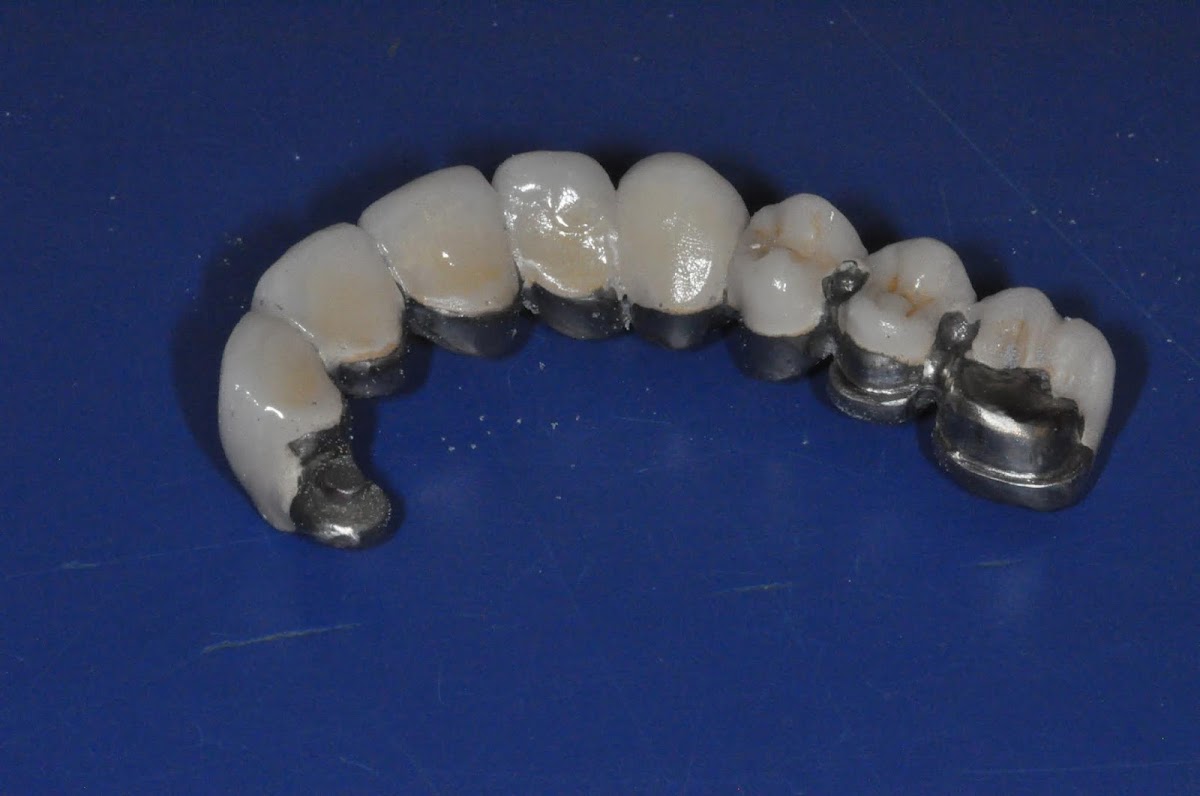Nashville Cosmetic and Implant Dentistry photo 6