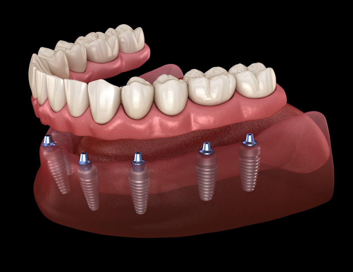 Gordon Dental Implants and Cosmetics photo 1