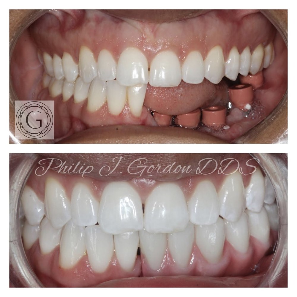 Gordon Dental Implants and Cosmetics photo 2