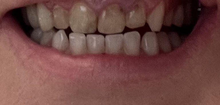 Saunders Family Dentistry photo 2