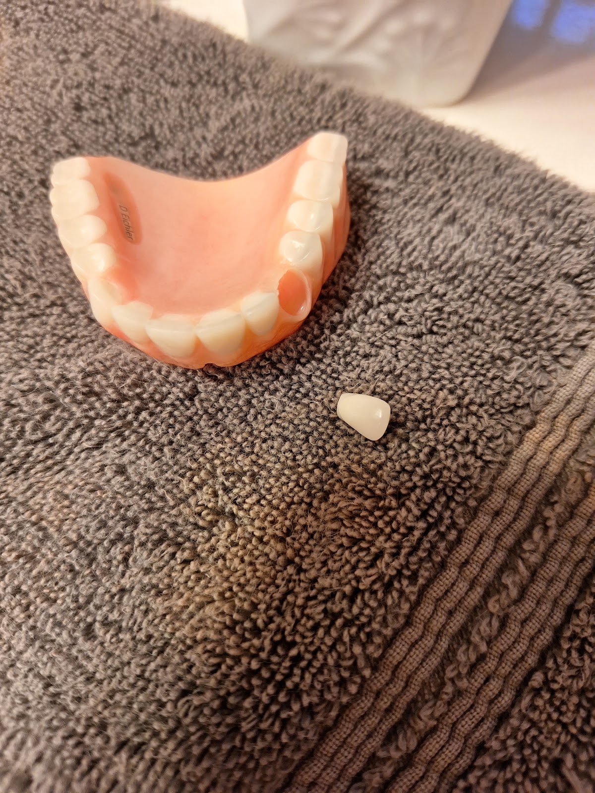 Aspen Dental - Prescott Valley photo 5
