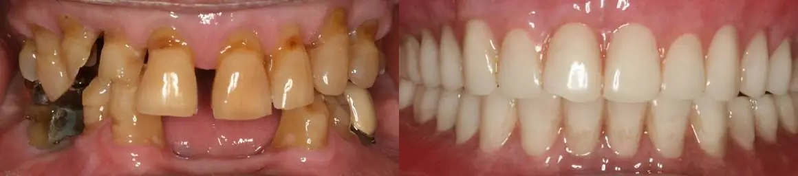West Dental Implants & Prosthetics photo 4