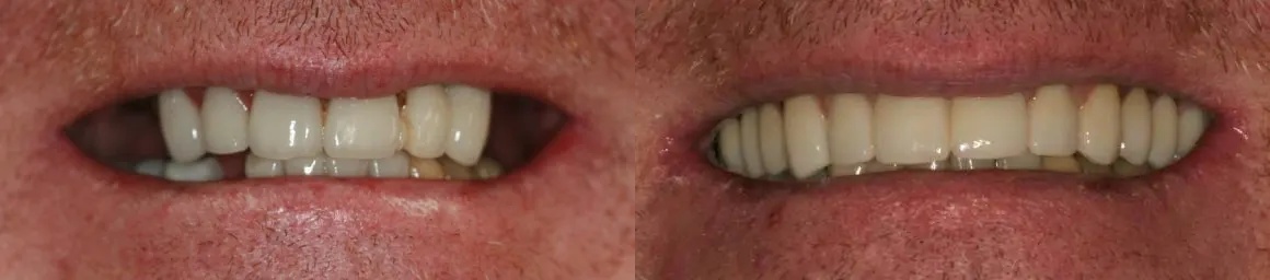 West Dental Implants & Prosthetics photo 5