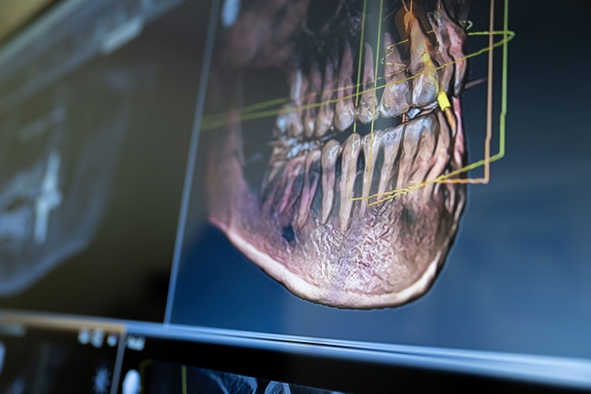 Commonwealth Periodontics and Implant Center photo 6