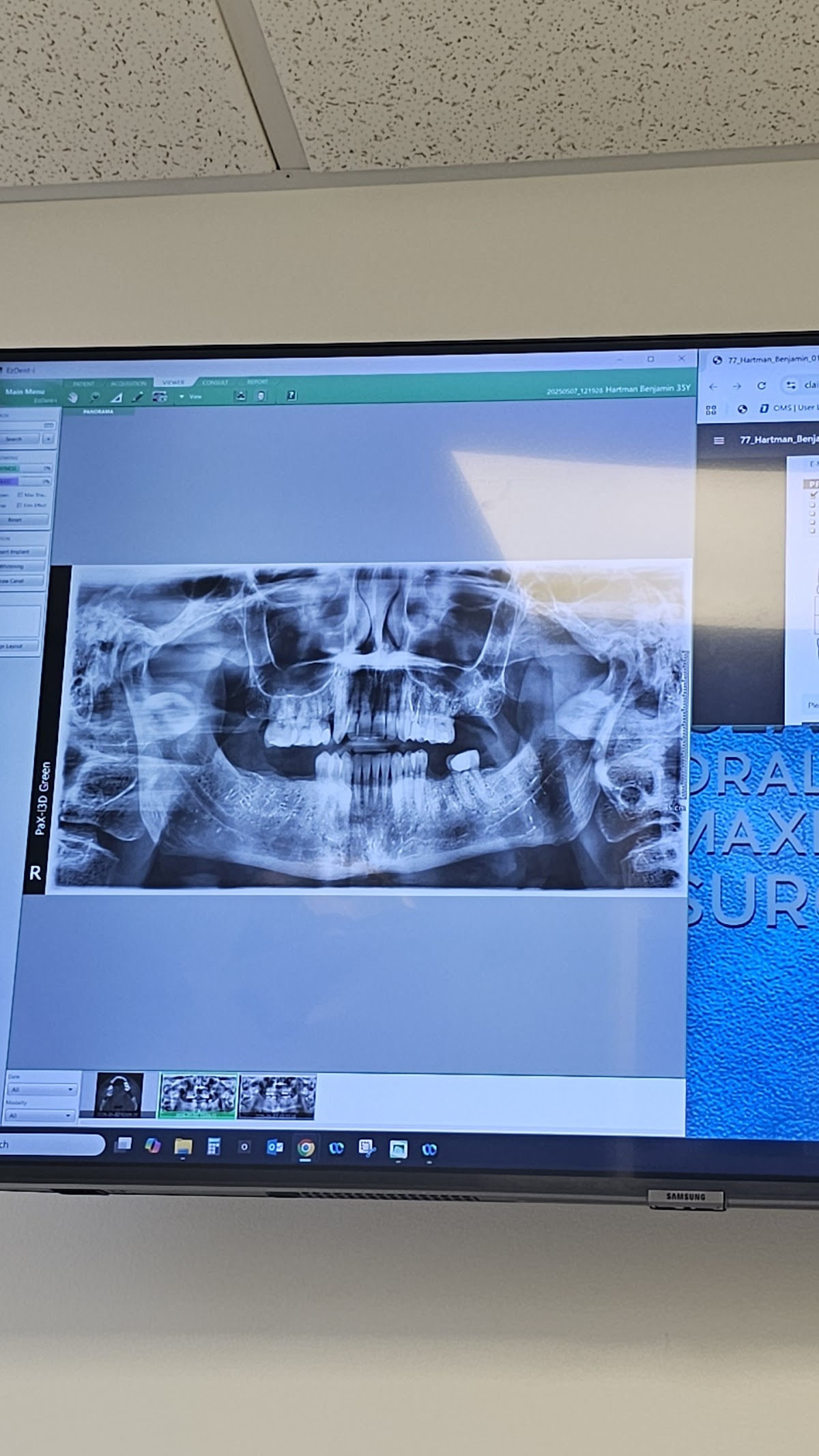 Mercer Island Oral & Maxillofacial Surgery photo 5