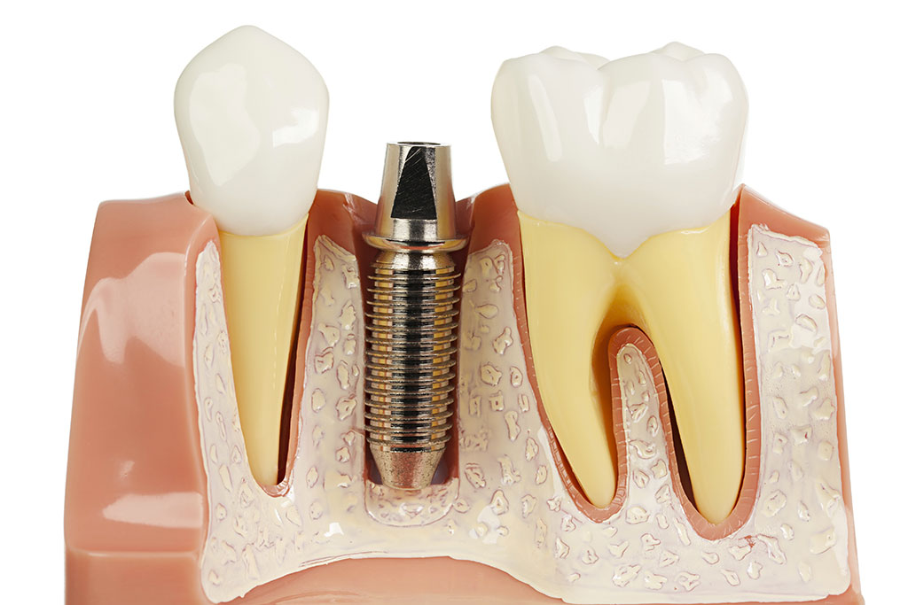 Meeks Oral and Maxillofacial Surgery: Meeks Darrell a DDS photo 6