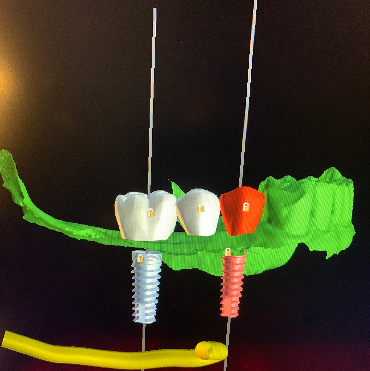 Institute for Periodontics and Implant Dentistry: Lance Culley, DDS photo 4