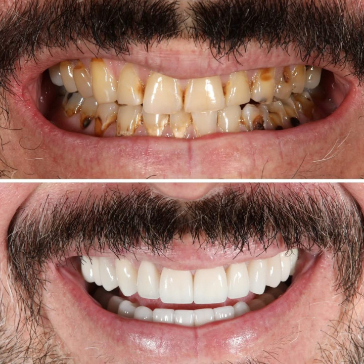 Boca Dentique photo 5