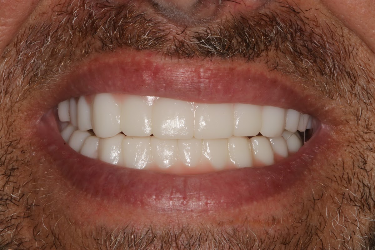 Dr. John Fish, DDS photo 5
