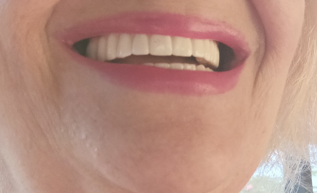 Total Arch Dental Implant Center photo 6