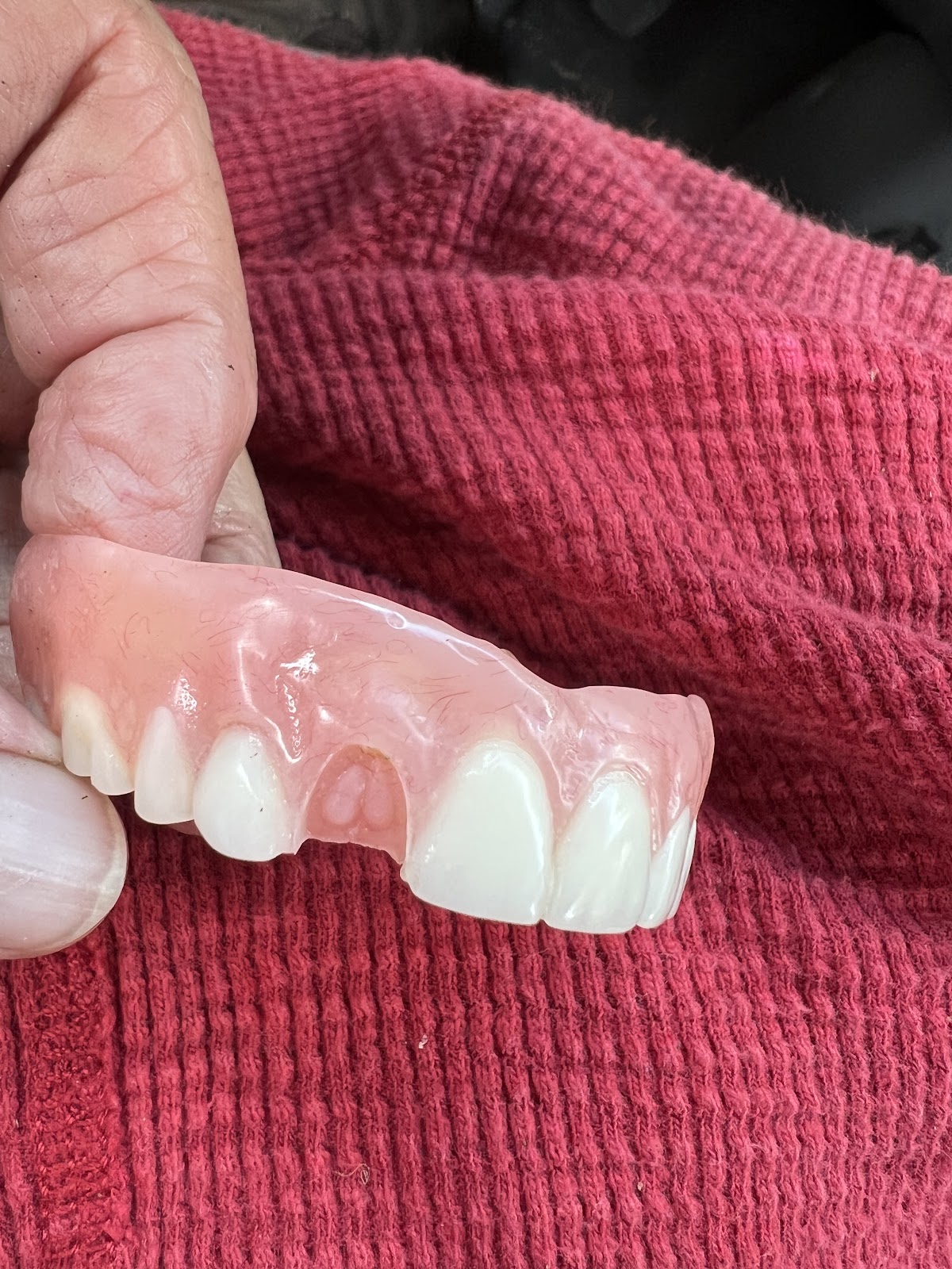 Aspen Dental - Plant City photo 3