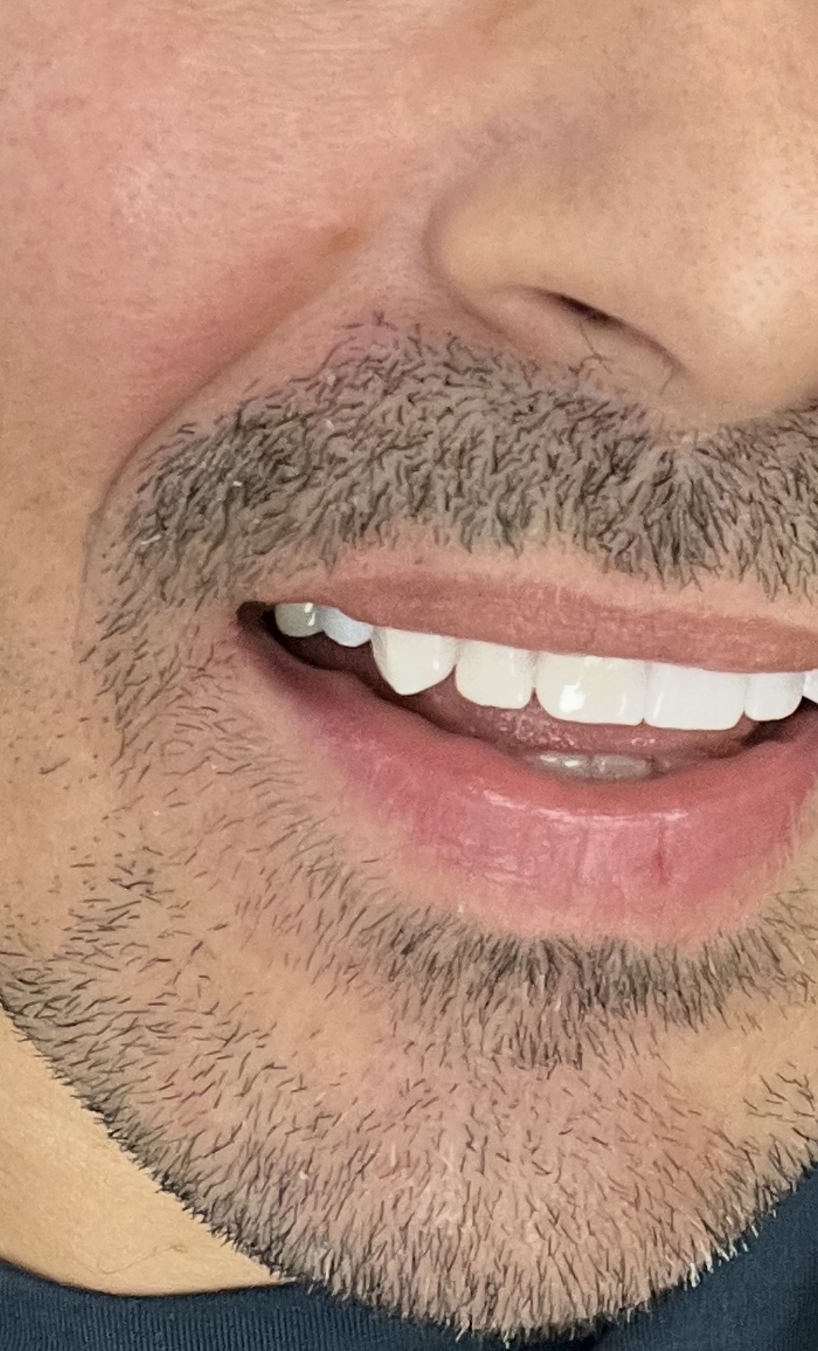 The Smile Mission - Fort Lauderdale photo 5