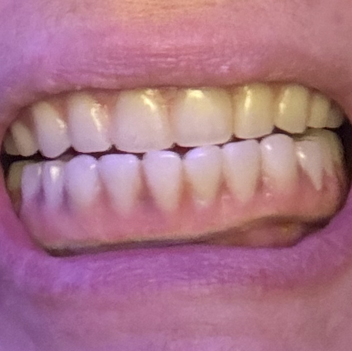Oppenheimer Dentistry photo 3
