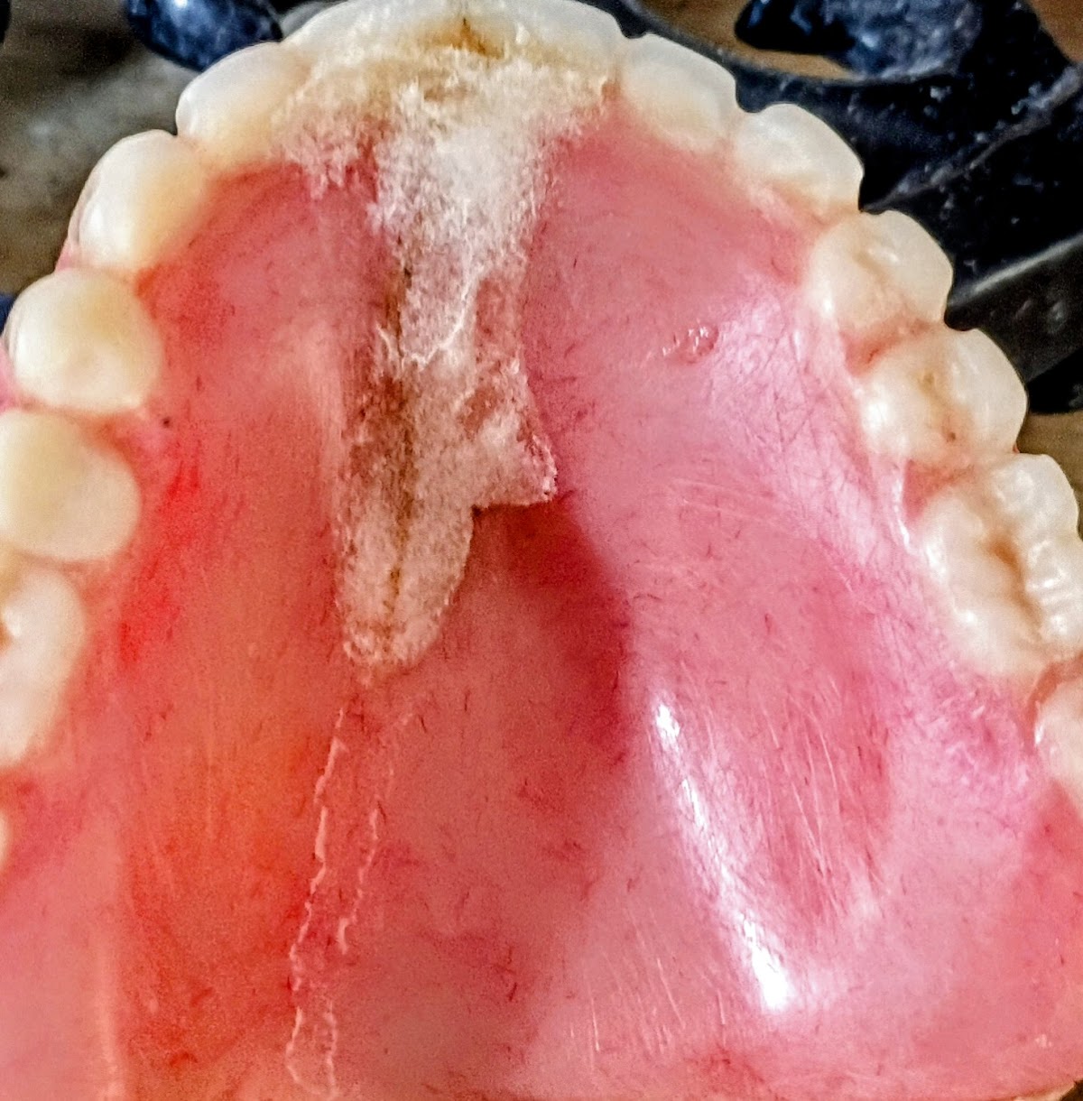 Affordable Dentures & Implants - Myrtle Beach photo 2