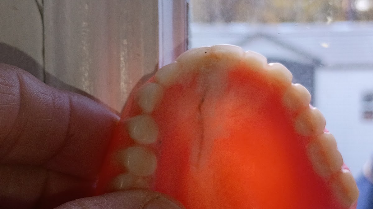 Affordable Dentures & Implants - Myrtle Beach photo 3