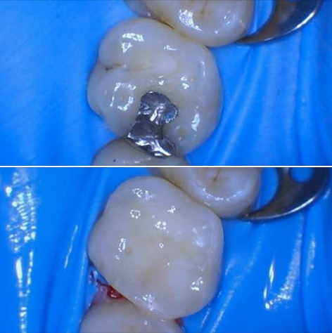 Omaha Laser Dentistry - Dr. Anthony Bolamperti photo 2