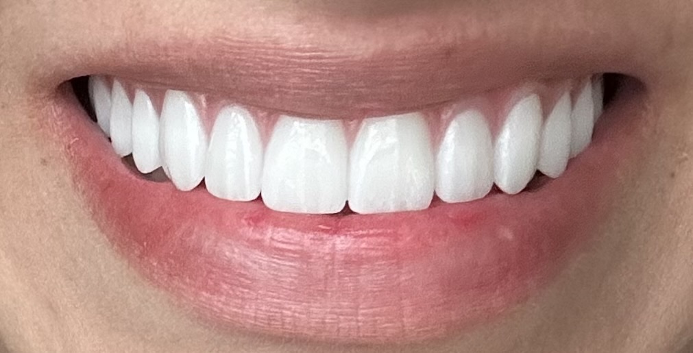 Clearchoice Dental Implant Center - Nashville photo 1