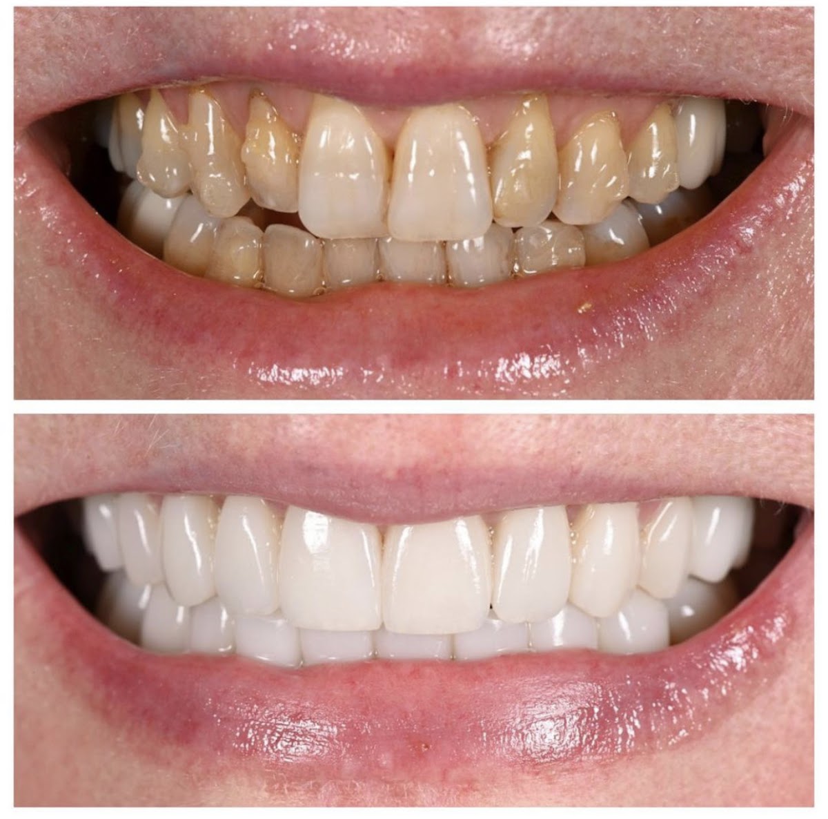 Minot Dental Partners photo 1