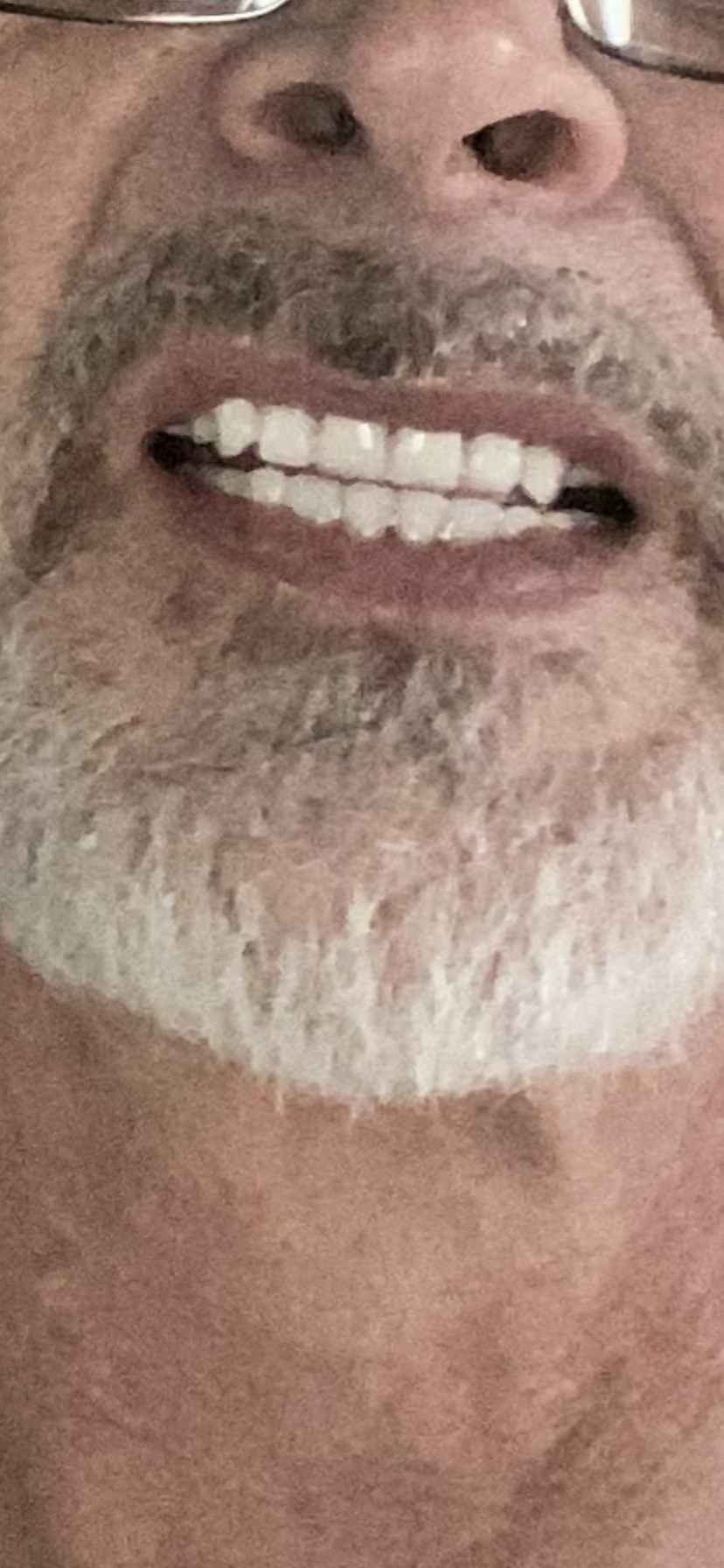 Affordable Dentures & Implants - Franklin photo 4
