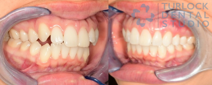 Turlock Dental Studio photo 6