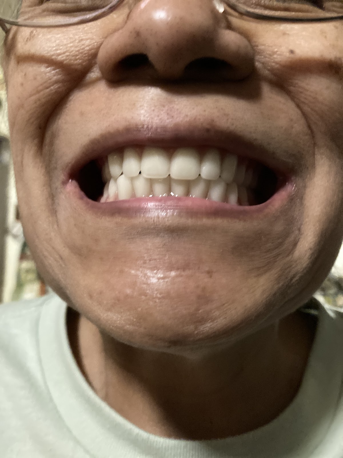 Care Dental photo 2