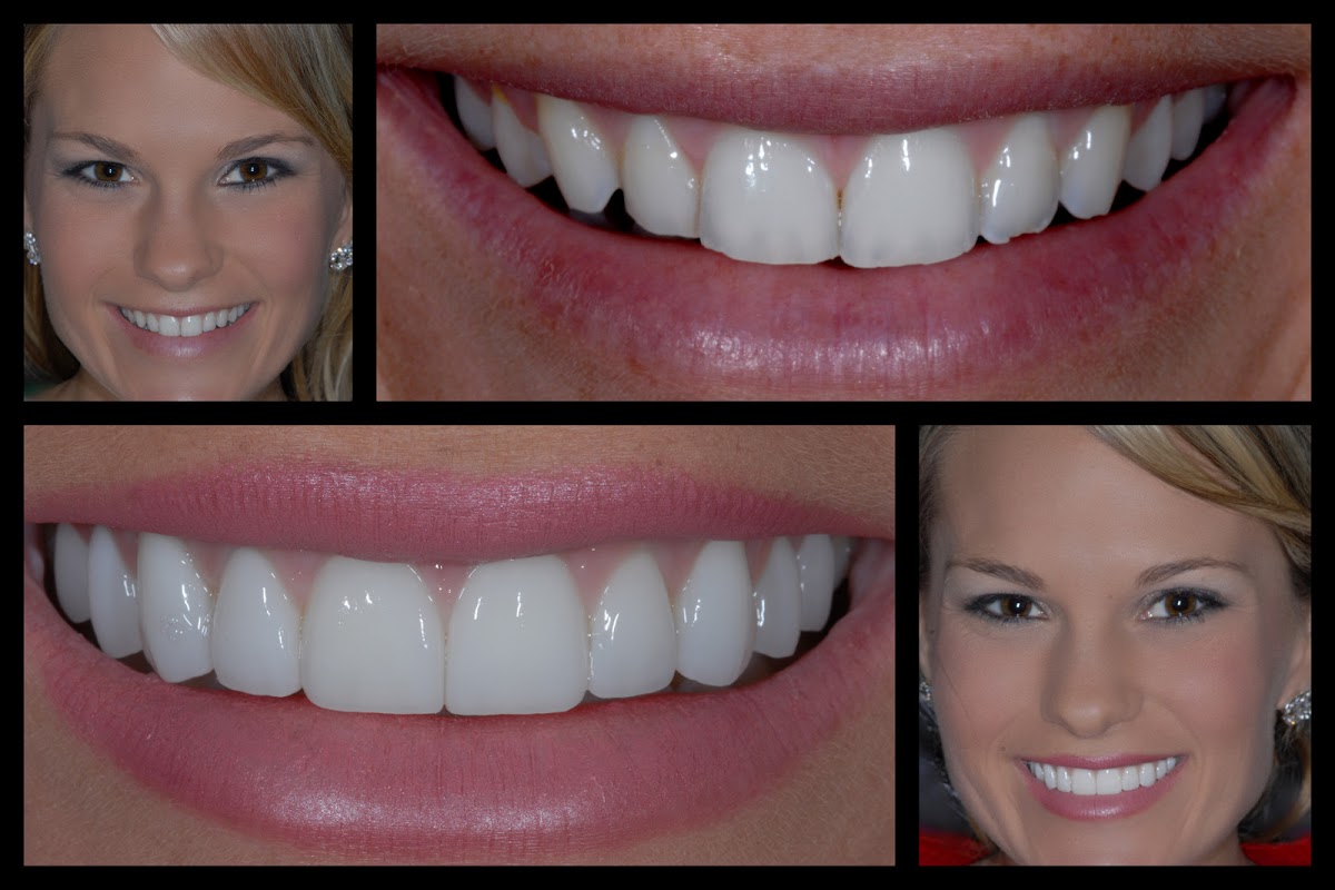 Texas Center For Cosmetic Dentistry, Dr. Guy Lewis And Dr. Teddy photo 2