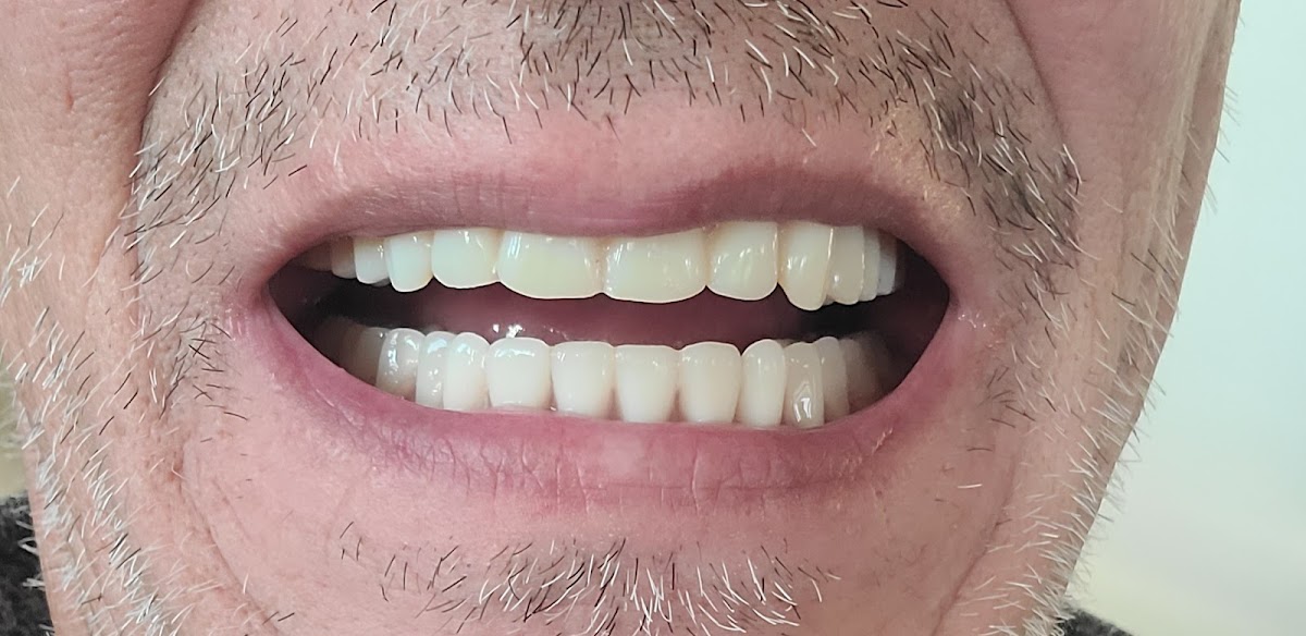 Aspen Dental - Mays Landing photo 3
