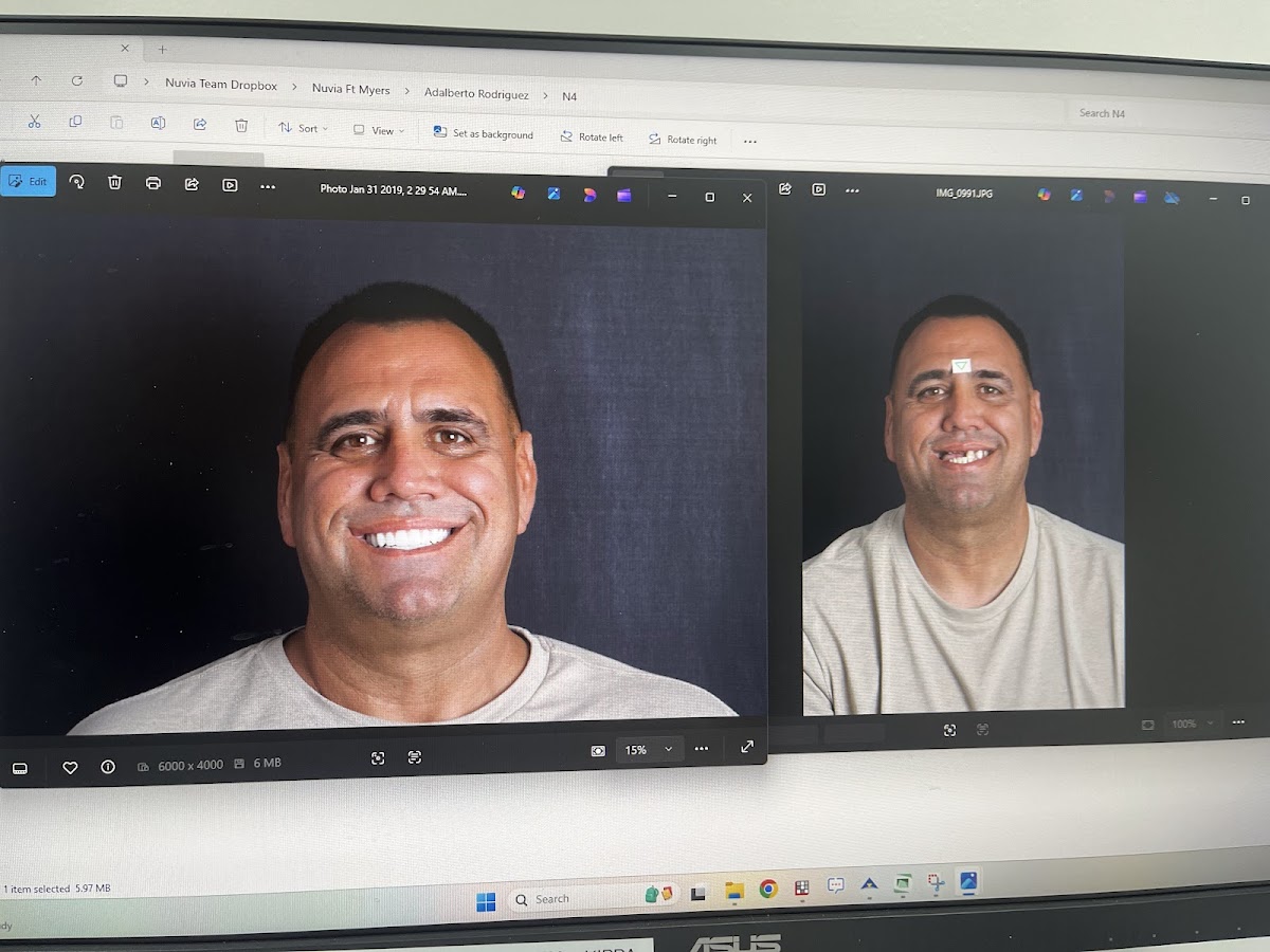 Nuvia Dental Implant Center - Fort Myers photo 1