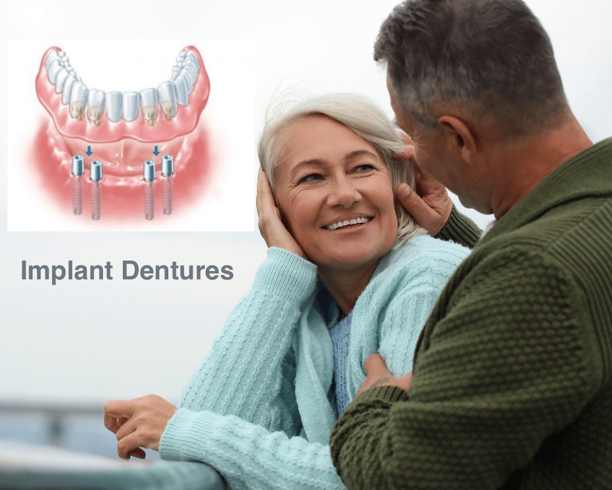 Affordable Implant Dentures photo 1