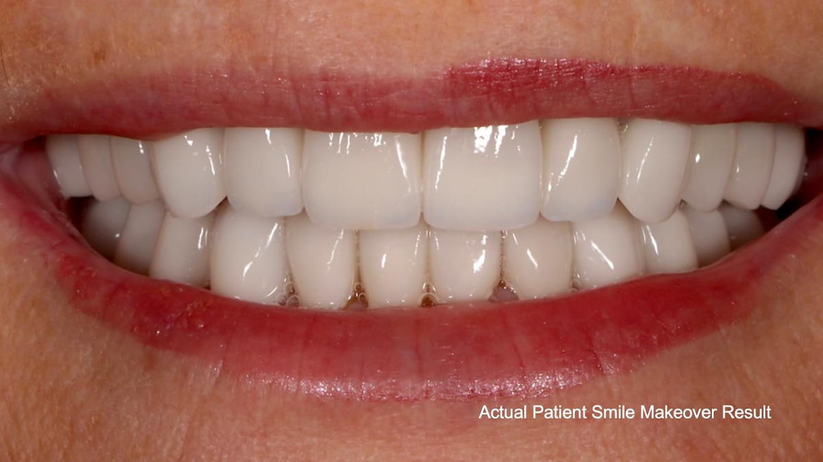 Advanced Dentistry of Amarillo photo 1