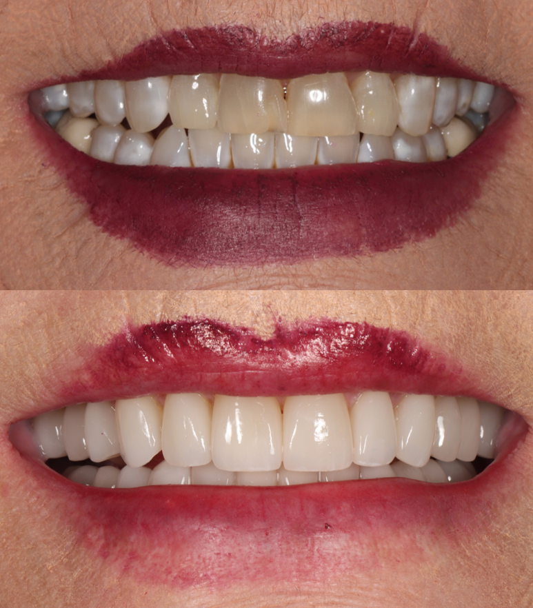 Advanced Dentistry of Amarillo photo 5